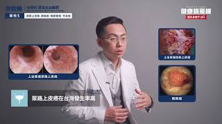 【李致樵醫師】無痛血尿勿輕忽！中年男罹患尿路上皮癌｜健康醫療網