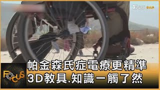 帕金森氏症電療更精準 3D教具.知識一觸了然｜方念華｜FOCUS全球新聞20250529 @tvbsfocus