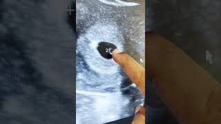 Early pregnancy scans || baby growth on scan || Dr. Silpahasa Samalla | gynaecologist | doctorsvlog