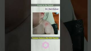 BCG vaccine