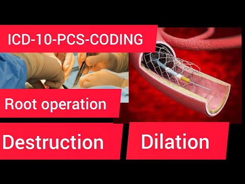 ICD-10-PCS coding-Root operation destruction & dilation