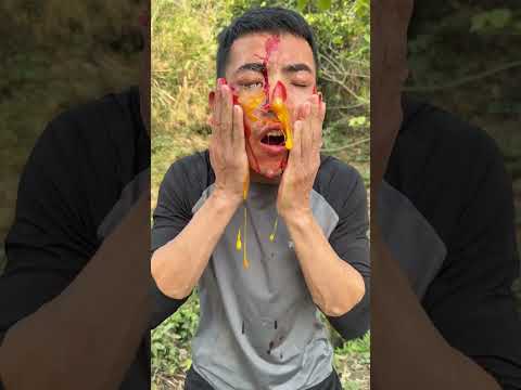 Wilderness Survival Hack: Treat Wounds Effectively with an Egg!