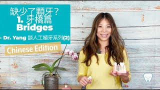當我缺了一顆牙, 有什麼治療選擇?_ 1. 牙橋篇_ Chinese edition 中文版_ Dr. Alice Yang 談人工植牙 (2)