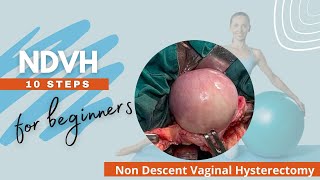 Non_Descent_Vaginal_Hysterectomy | NDVH in Ten Steps | NDVH for Beginners | Dr Deeksha Pandey