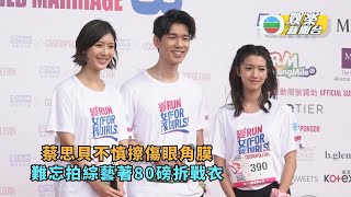蔡思貝不慎擦傷眼角膜 難忘拍綜藝著80磅拆戰衣