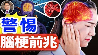 早上有這3個症狀，當心是腦梗警訊⚠️