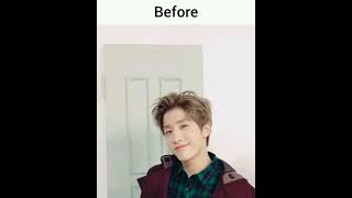 Astro before & after plastic surgery #astro #mj #jinjin #chaeunwoo #moonbin #rocky #sanha #aroha