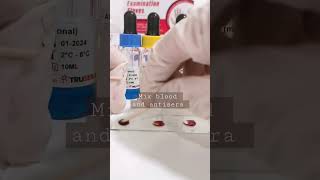 Let's do blood typing #blood #bloodgroup #medtech #Rh #Rhpositive #abobloodgroup