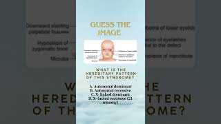 Guess the image #tooth #neetmdslectures #exam #dentalexam
