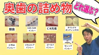 【インレー、詰め物8選】セラミック？銀歯？ジルコニア？　虫歯ができた時のおすすめ治療法｜歯医者が解説