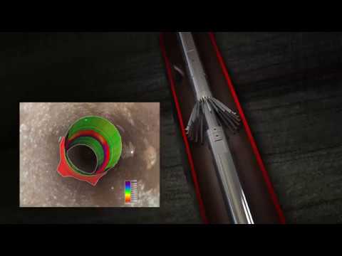 DHVI -  Downhole Video & Intervention - Capture C3