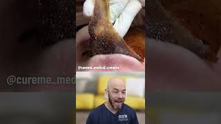 This mask peels right off! 🍌 (credit: @cureme_medical_complex on TT) #facemask #fyp #satisfying