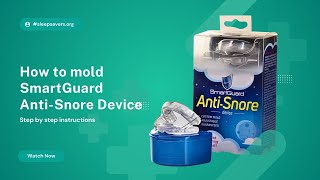SmartGuard Anti-Snore Device: Step-by-Step Molding Instructions