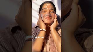No more acne #shorts #acnetreatment #acnefacemask