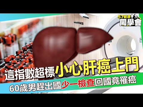 這指數超出標準值「小心肝癌找上門」！？ 60歲男趕出國「少一檢查」回國竟發現罹癌？【 @57healthy  】#江坤俊 醫師