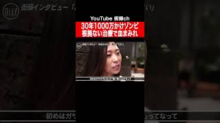 アトピー新治療に挑むも皮膚なくなり血まみれ #shorts