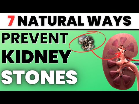 Top 7 Proven Methods to Prevent Kidney Stones and Improve Your Kidney Health | 1Stop Health