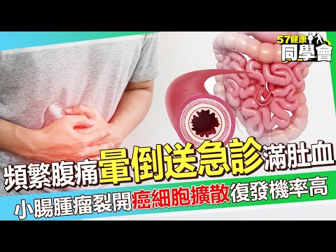 大二生頻繁腹痛「暈倒送急診」滿肚都是血？！ 小腸惡性腫瘤裂開「癌細胞擴散」復發機率高！【 @57healthy  】#江坤俊 醫師