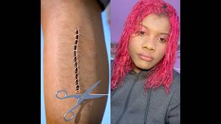 How Stitches Work 🤕 #shorts #viral #facts