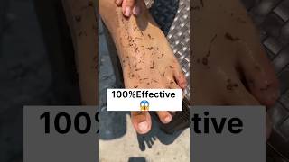 Permanent Feet Dirt & Tanning Removal Pack/Most Easy Pedicure,Try This Pack #skincare#ytshorts#viral