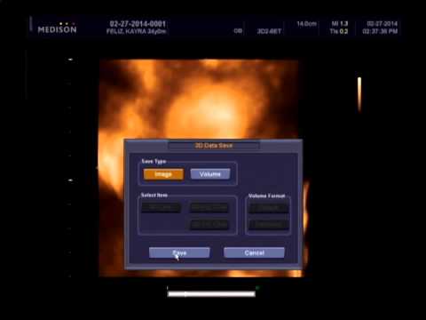 Aiden's 4D Ultrasound Part 2