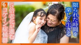 【”限られた毎日”を思い出に】「寿命短いので…」５倍早く老化が進む「コケイン症候群」　今を楽しむ母子の笑顔【newsおかえり特集】