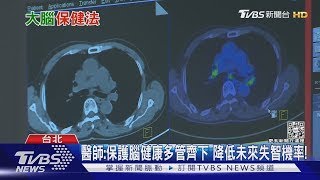 保護腦健康! 醫師:從「這幾個」危險因子預防..否則下場慘!｜十點不一樣20230206