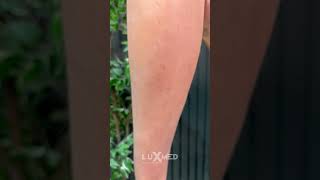 Silicone prostheses that will amaze with their realism #prosthetics