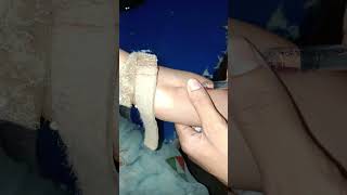 intravenous Gentamicin enjetion IV #shorts #trending