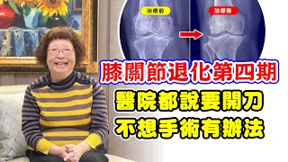 名冠診所【膝關節退化治療】膝關節退化第四期  上下樓梯劇痛不能走 非開刀治療恢復靈活人生