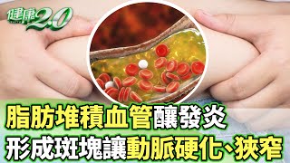 脂肪堆積血管釀發炎 形成斑塊讓動脈硬化、狹窄【健康2.0分段】@tvbshealth20   EP3000-1  20250330 #鄭凱云 #康志森 #蔡時安 #吳宏乾 #許聖梅