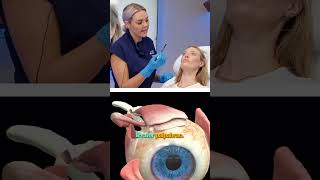 Botox brow lift technique 💉