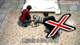 女友救癲癇男　慘被咬傷手