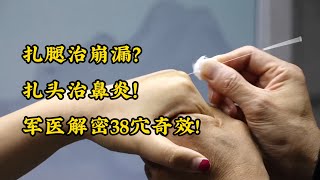 10针停4年崩漏！平衡针灸3秒止痛术让西医叹服---平衡针灸5。#中医 #鼻炎  #针灸 #中医健康