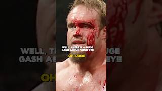 When Maven Broke Snitsky's Orbital Bone 😯