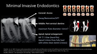 Minimally Invasive Endodontics Access Opening ft. 吳宇蓁醫師