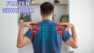 ACUPUNCTURE TREATMENT FOR FROZEN SHOULDER (ADHESIVE CAPSULITIS)