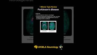 Parkinson's disease #medicaleducation #neuroscience #ukmla #shorts
