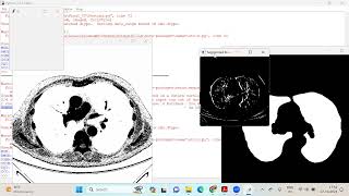 Lung Segmentation In Ct Images Using Unet #finalyearprojects #machinelearningprojects  #bangalore