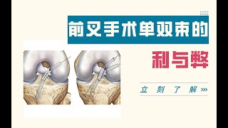 膝关节前叉手术单束与双束的利与弊?