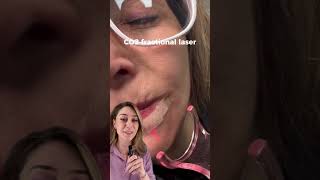 Co2 Laser for Wrinkles Around Your Mouth #co2laser #wrinkles #dermatologist