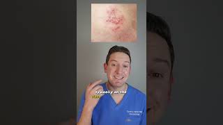 Is that Acne or Face Herpes? Dermatologist explains Herpes Gladiatorum #herpes #wrestling