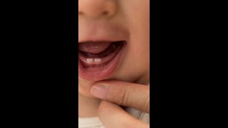 Signs of teething in babies