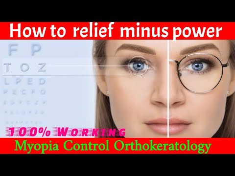 How to relief minus power| myopia control Orthokeratology |OrthoK lens। Dr Mantu Akon