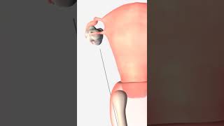 how does IVF work_eggg Retrieval process in ivf_ Animation video. #animations #egg #shorts #ivf