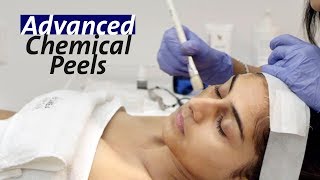 Skin Peels & Chemical Peels at The Bombay Skin Clinic in Mumbai