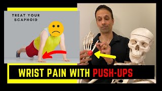 Can't do push-ups WRIST PAIN Treat the Scaphoid