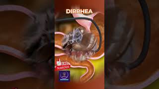 Diarrhea Formation: Causes, Mechanism, and Prevention Explained
