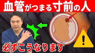 血管 詰まる サイン 脳梗塞 心筋梗塞 動脈硬化寸前の人だけに現れる危険な症状8選！毎日できる10秒の血管セルフトレーニング