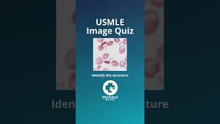 ⬆️More high yield USMLE here | 📌Answer in comments #usmle #usmlestep1 #medstudent #medschool #shorts